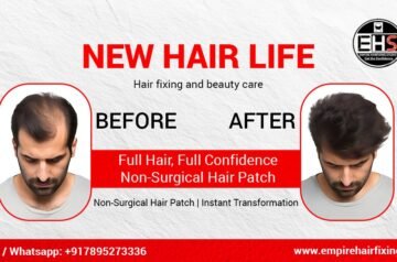 Restore Your Look with the Best Hair Patch in Jaipur