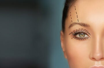 Eyelid Surgery in Islamabad – Brighten and Refresh Your Eyes