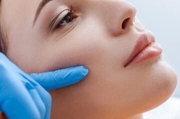 Cheek Lift in Islamabad – Restore Youthful Volume and Contours