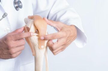 Orthopaedic Surgery in Kenya: Best Specialists for Joint, Spine & Sports Injuries