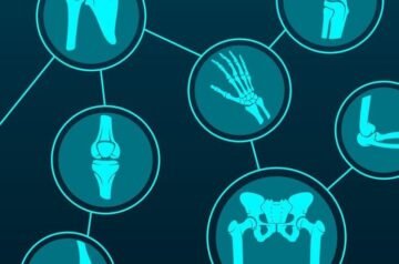 Best Orthopedic Doctor in Indore – Expert Bone & Joint Specialist Dr. Sanjay Rawat