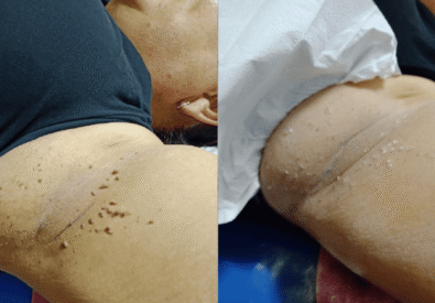 A.H. Advanced Skin S...