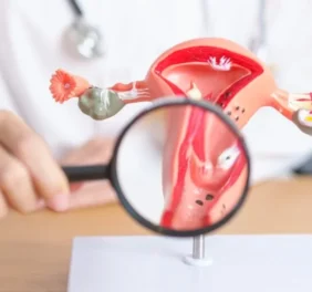 Fibroids Treatment i...