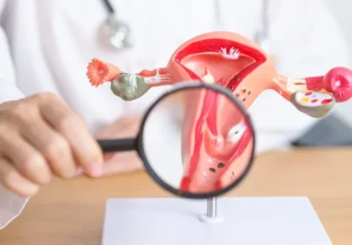 Fibroids Treatment i...