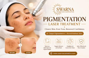 Laser Treatment for Acne Scars and Advanced Solutions for Clear, Even-Toned Skin