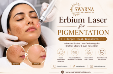 Can Laser Treatment for Acne Scars Also Reduce Pigmentation and Dark Spots?