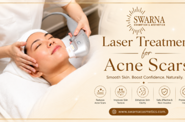 Swarna Cosmetics Expert Laser Treatments For Acne Scars And Pigmentation