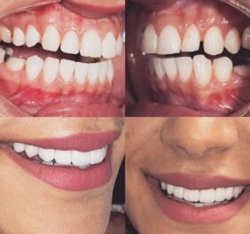Charm Dental Katy
