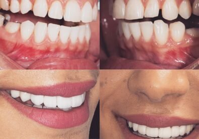 Charm Dental Katy