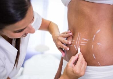 Liposuction Surgery ...