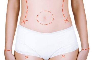 Top Reasons to Choose Mommy Makeover Lounge for Your Transformation