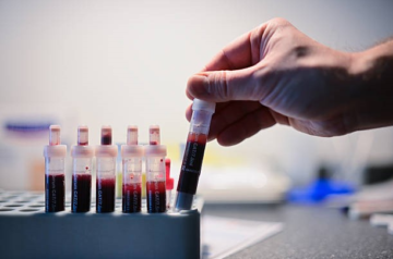 What Blood Drug Testing Disputes Reveal About Toxicology Evidence in Court