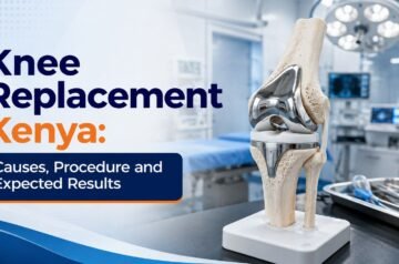 Knee Replacement Kenya: Causes, Procedure and Expected Results