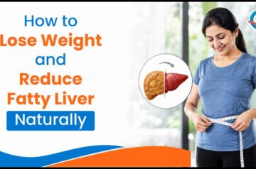 How to Lose Weight and Reduce Fatty Liver Naturally