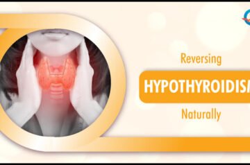 How to Reverse Hypothyroidism Naturally?
